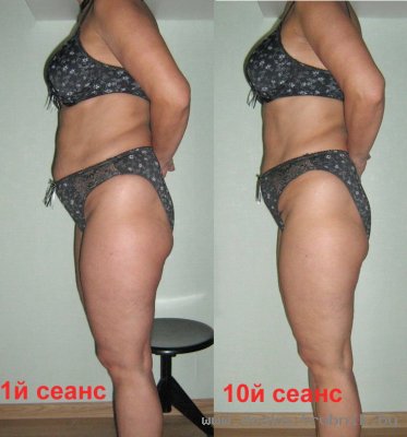 Качественный массаж. Недорого! Антицеллюлитный, лечебный.